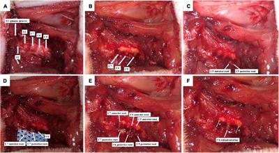 Astaxanthin-folic acid combined treatment potentiates neuronal regeneration and functional recovery after brachial plexus avulsion and reimplantation